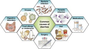 Common causes of diarrhea