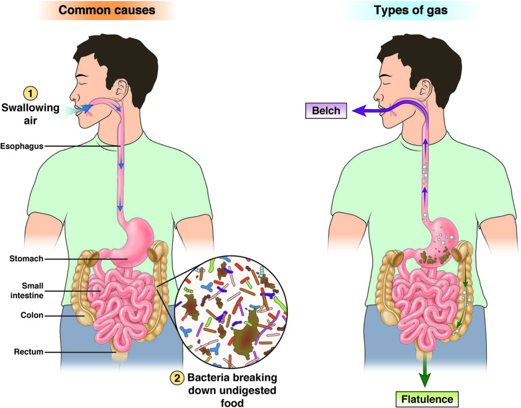 Common causes of gas