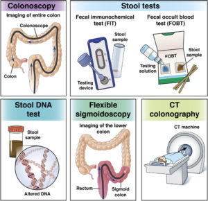 Colorectal cancer (CRC) screening options