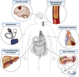 Medical consequences of obesity